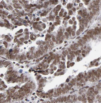 COPS2 Rabbit Polyclonal Antibody