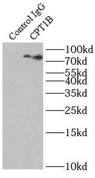 CPT1B specific Rabbit Polyclonal Antibody