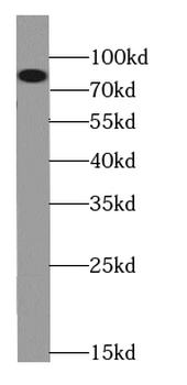 CPT1B specific Rabbit Polyclonal Antibody