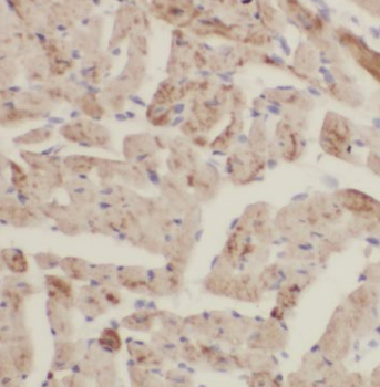 CPT1B specific Rabbit Polyclonal Antibody