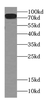 CPT1C Mouse Monoclonal Antibody