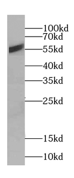 CREB3L1 Rabbit Polyclonal Antibody