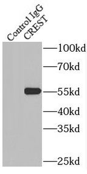 SS18L1 Rabbit Polyclonal Antibody