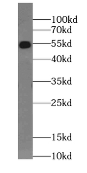 SS18L1 Rabbit Polyclonal Antibody