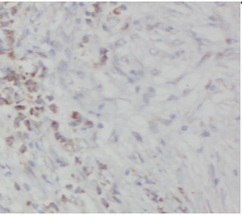SS18L1 Rabbit Polyclonal Antibody