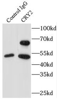 CRY2 Rabbit Polyclonal Antibody