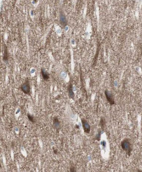 CRY2 Rabbit Polyclonal Antibody