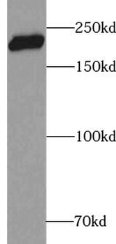 CSPG4 Rabbit Polyclonal Antibody