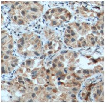 CSPG4 Rabbit Polyclonal Antibody