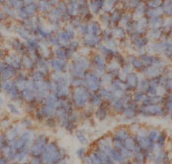 CUL4A Specific Rabbit Polyclonal Antibody