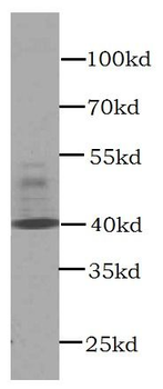 CXCR3 specific Mouse Monoclonal Antibody