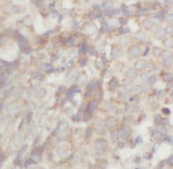 ACKR3 Mouse Monoclonal Antibody