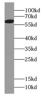 TXLNG Rabbit Polyclonal Antibody