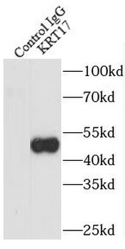 KRT17 Specific Rabbit Polyclonal Antibody
