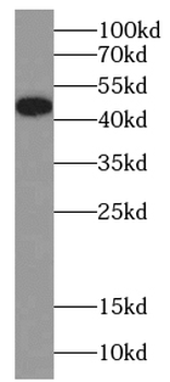 KRT17 Specific Rabbit Polyclonal Antibody
