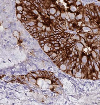 KRT17 Specific Rabbit Polyclonal Antibody