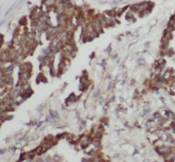 KRT6A Rabbit Polyclonal Antibody