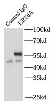 KRT6A specific Rabbit Polyclonal Antibody