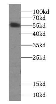 KRT6A specific Rabbit Polyclonal Antibody