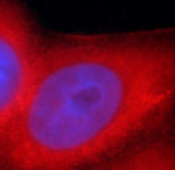 KRT7 specific Rabbit Polyclonal Antibody