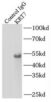 KRT7 specific Rabbit Polyclonal Antibody