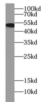 KRT7 specific Rabbit Polyclonal Antibody