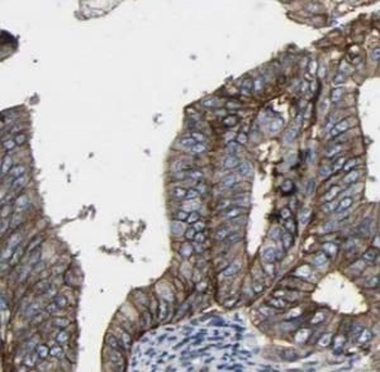 KRT7 specific Rabbit Polyclonal Antibody