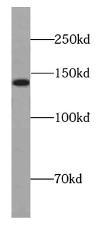 DIAPH1 Rabbit Polyclonal Antibody