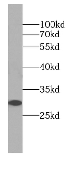 DNAJB3 Rabbit Polyclonal Antibody