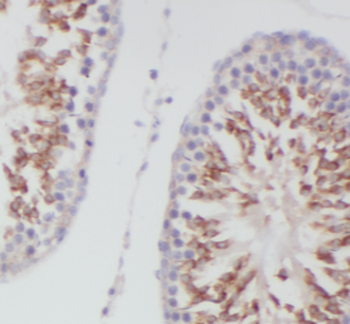 DNAJB3 Rabbit Polyclonal Antibody