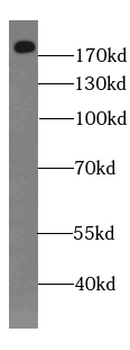 DOCK1 Rabbit Polyclonal Antibody