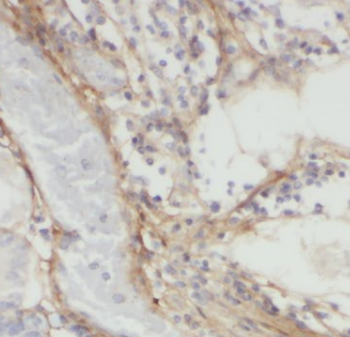 DOCK1 Rabbit Polyclonal Antibody