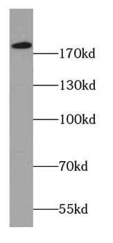 DOCK1 Specific Rabbit Polyclonal Antibody
