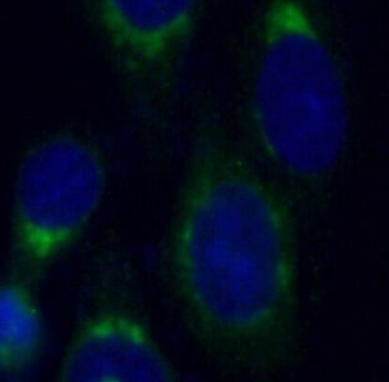 FAM3C Mouse Monoclonal Antibody