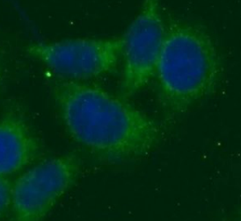 FTL Rabbit Polyclonal Antibody