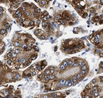 FTL Rabbit Polyclonal Antibody