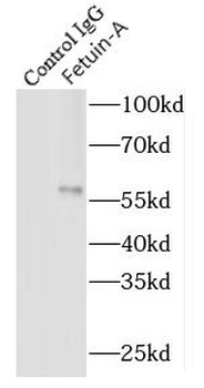 AHSG Mouse Monoclonal Antibody