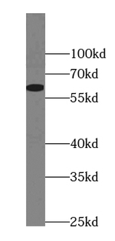 AHSG Mouse Monoclonal Antibody