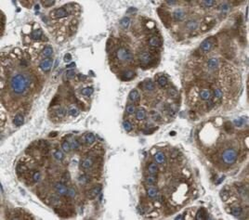AHSG Mouse Monoclonal Antibody