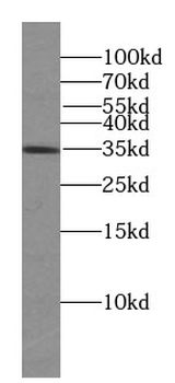 FST Mouse Monoclonal Antibody