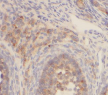 FST Mouse Monoclonal Antibody