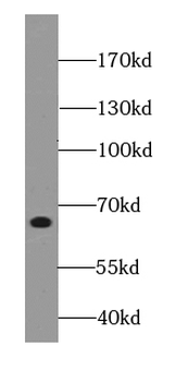 FZD10 Rabbit Polyclonal Antibody