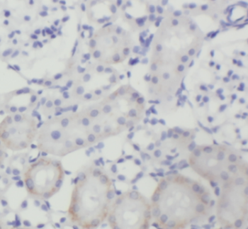 FZD10 Rabbit Polyclonal Antibody