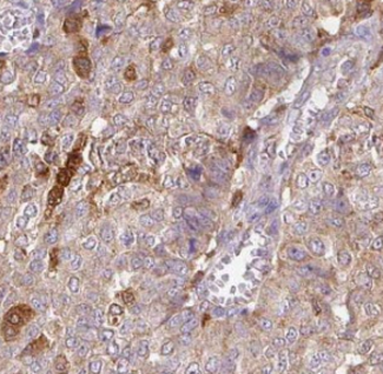 GABARAPL1 Specific Rabbit Polyclonal Antibody