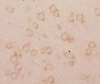 SLC1A3 Rabbit Polyclonal Antibody