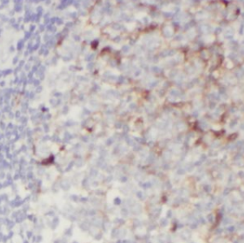 GCA Rabbit Polyclonal Antibody