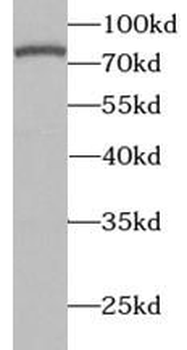 GRN Rabbit Polyclonal Antibody
