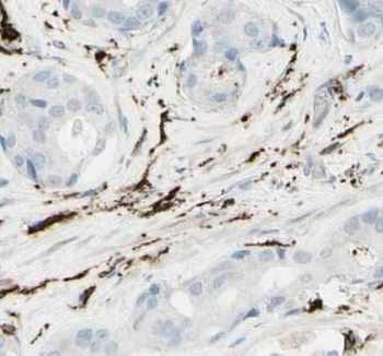 GRN Rabbit Polyclonal Antibody