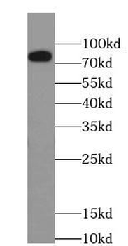 GRN Rabbit Polyclonal Antibody