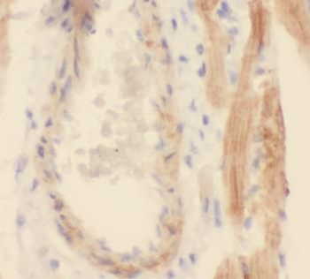 GRN Rabbit Polyclonal Antibody